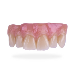 Harvest EasyGum Gingival Composite Strip